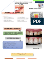 Diastema S