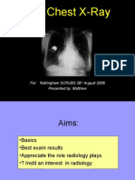 The Chest X-Ray: For: Nottingham SCRUBS 26 August 2006 Presented By: Matthew