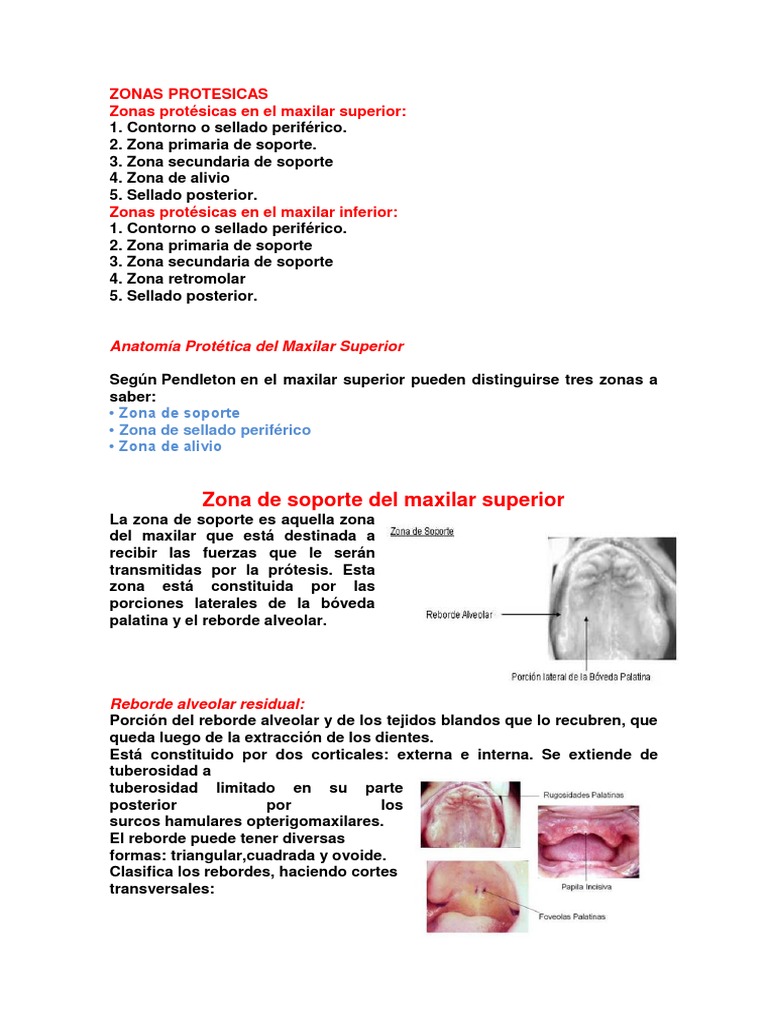 Zonas Protésicas en Maxilares Superior e Inferior | PDF | Dentadura ...