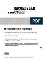 Supracondylar Fracture