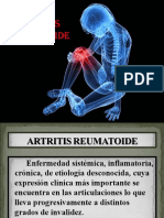 Artritis Reumatoide