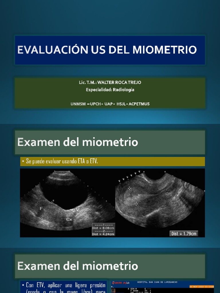 Criterios de Musa en Miometrio y Adenomiosis | PDF | Especialidades ...
