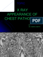 X Ray Appearance of Chest Pathology