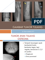 Gbr Bimb Tumor Tulang