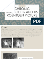 Chronic Mastoiditis and Its Roentgen Picture