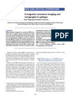 Diffusion-Based Magnetic Resonance Imaging and Tractography in Epilepsy