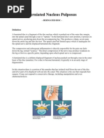 Download Herniated Nucleus Pulposus by shezar SN37028963 doc pdf