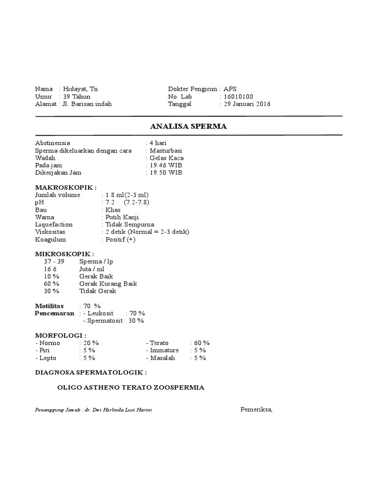 HD formatda porno tomosha qiling