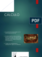 Cálculo Periodoncia