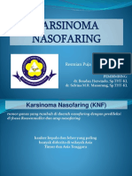 Karsinoma Nasofaring THT