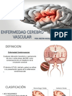 Enfermedad Cerebro Vascular