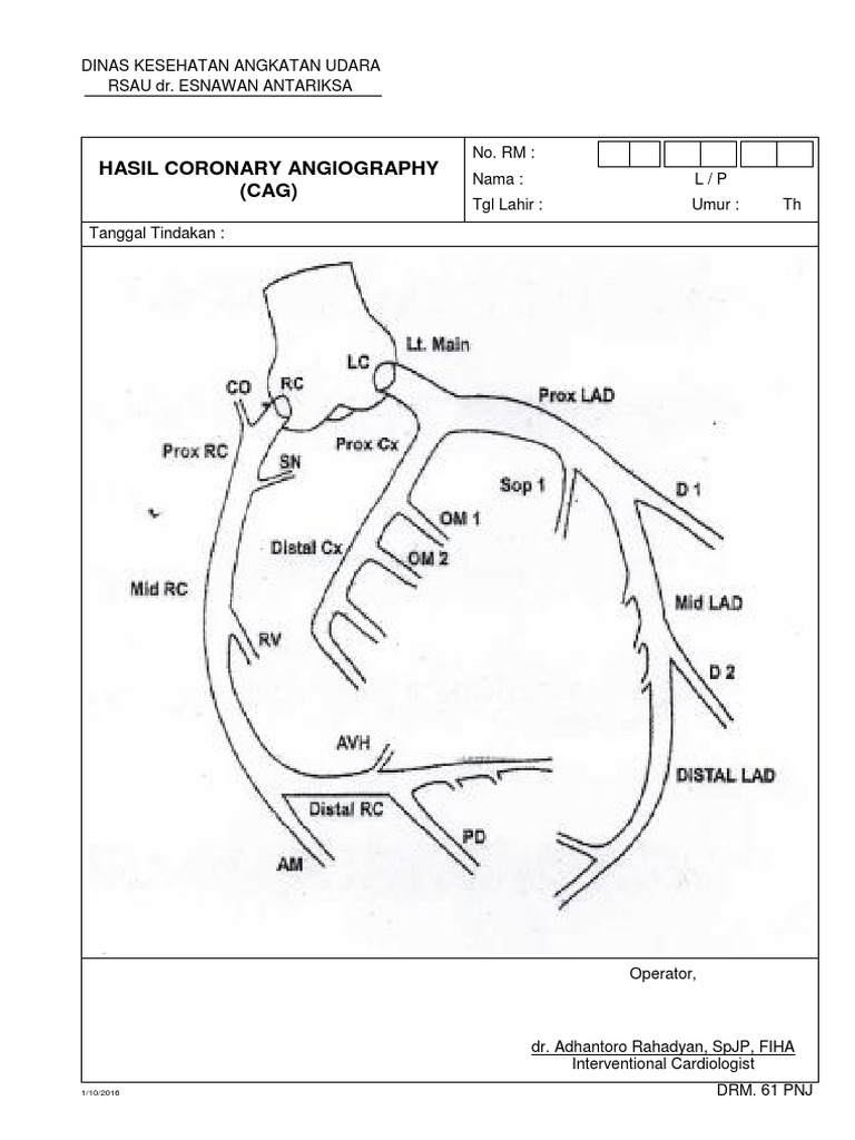 Hasil Coronary Angiography Cag Pdf Self Improvement Science