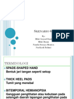 Acromegaly Syad, Nda, Mi, San