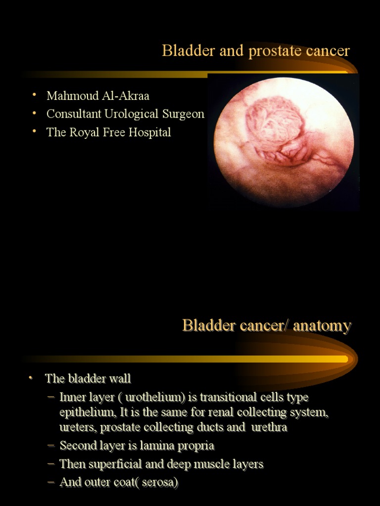 Bladder and Prostate Cancer | PDF | Cancer | Urinary Bladder