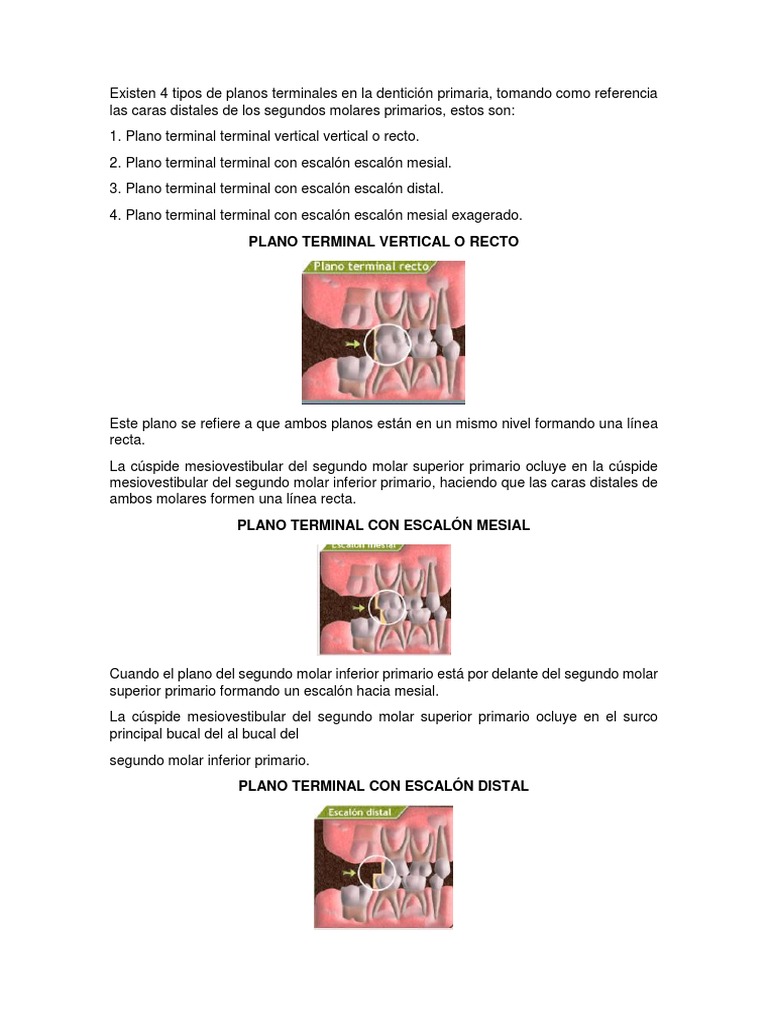 Existen 4 Tipos de Planos Terminales en La Dentición Primaria