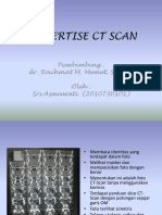 Ekspertise CT Scan Sinus
