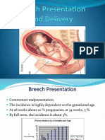 Breech Presentation