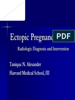 Ectopic Preg pdf.pdf