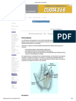 Enfermedad de Dupuytren