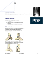 Malleolar Fractures - Handout PDF