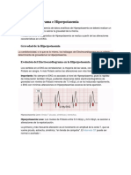 Electrocardiograma e Hiperpotasemia