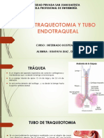 Tubo Traqueotomia y Tubo Endotraqueal