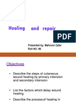 Healing and Repair: Presented By: Mahnoor Zafar Roll NO: 86