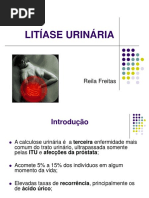 apresentaçao litiase