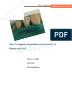 Class V Composite Preparation and Restoration On Human Toothpdf