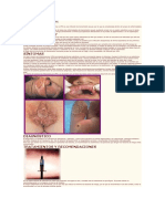 Virus de Papiloma Humano VPH