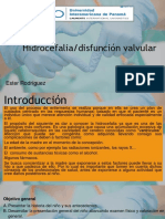 Hidrocefalia Disfunción Valvular