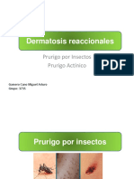 Dermatosis Reaccionales