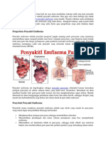 Cara Mengobati Penyakit Emfisema Yang Mudah