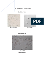 Urine Sediment Constituents: Red Blood Cells