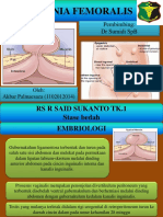 Hernia Femoralis