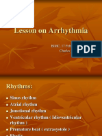 Lesson On Arrhythmia - Charles Hoo, MD