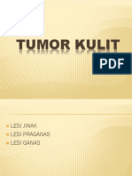 2. Tumor Kulit - Copy