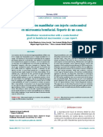 Microsomia Craneofacial