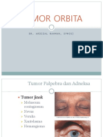 Tumor Orbita DR Ardizal Rahman