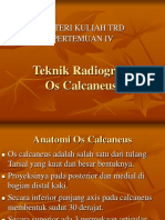 Pertemuan IV (Calcaneus)