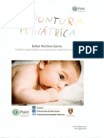 Acupuntura Pediatrica