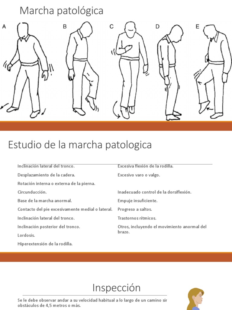 Tipos de Marcha Patológica y Anormal | PDF | Pie | Sistema ...