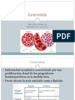 Leucemia Semiologia