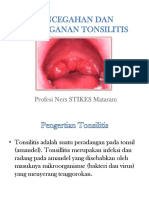 Tonsilitis Eda