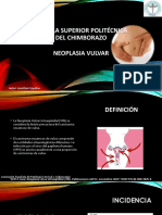 Neoplasia Vulvar