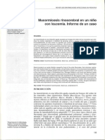 Mucormicosis rinocerebral en un niño con leucemia