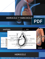 HIDROCELE.pptx