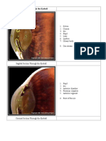 Sagittal Section Through the Eyeball.doc