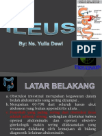 Ileus