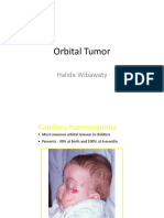 Orbital Tumor